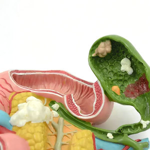 DARHMMY Modello Anatomico del Pancreas Patologico in PVC a Grandezza Naturale per Formazione Medica, Ospedaliera ed Educativa - Product Image 5
