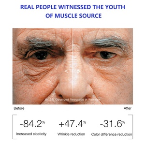 Ekber Sản Phẩm Mới Da Tự Nhiên Đàn Hồi Dưỡng Ẩm Khuôn Mặt Huyết Thanh Thắt Chặt Chống-Lão Hó<span class=keywords><strong>a</strong></span> Đồng <span class=keywords><strong>Peptide</strong></span> Huyết Thanh - Product Image 6