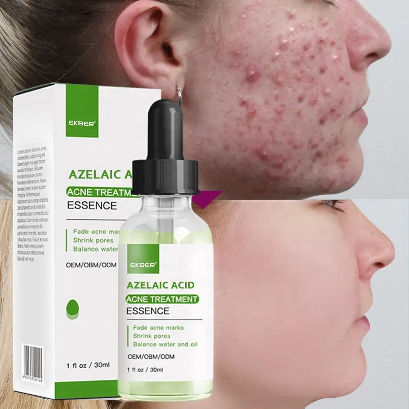 Ekber-sérum pour le visage à l'acide azelaïque 10%, produit de soin pour le visage, avec Centella Black Head Remover, offre spéciale, 30ml