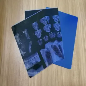 Medical print X-ray film