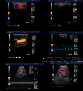 Système d'échographie Doppler couleur numérique complet CE JM-908A sur chariot, idéal pour des diagnostics complets, y compris abdominaux - Product Image 2