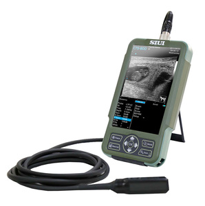 Dispositivo de Diagnóstico por Ultrasonido Veterinario SIUI CTS-800 para Ganado, Gatos y Ovejas, Ecógrafos Veterinarios de Delta Medical - Product Image 3