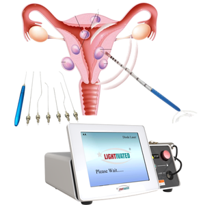 Utilisation par le médecin Laser de gynécologie Laser 980nm 1470nm Atrophie vaginale Fibromes utérins Traitement des fibromes ovariens Dispositif laser - Product Image 1
