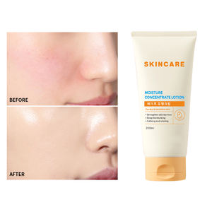 Lotion corporelle hydratante et éclaircissante OEM à l'acide kojique, à l'acide hyaluronique, au niacinamide et à la vitamine C pour adultes 300ml - Product Image 1