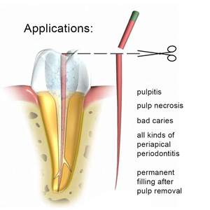<span class=keywords><strong>Gutta</strong></span> <span class=keywords><strong>percha</strong></span> มีขนาด F1 F3 F2สำหรับรักษารากฟัน - Product Image 6