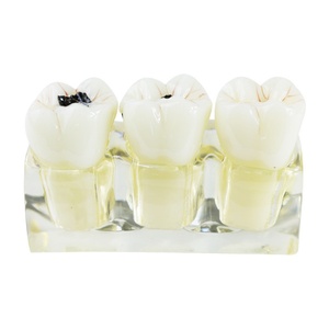 Modèle dentaire pathologique amovible 4 en 1 : Anatomie des caries, décomposition des dents, éducation et hygiène buccale polyvalente - Product Image 1