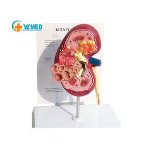 نماذج أبحاث التشريح الطبي ، عالية الجودة, نماذج أمراض الكلى ونماذج الكلى الصحية - Product Image 1
