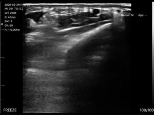 Sonde d'échographie sans fil Wifi <span class=keywords><strong>USG</strong></span>, compatible IOS et Android, sonde transvaginale, sonde d'échographie portable sans fil pour vétérinaires - Product Image 6