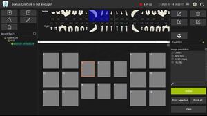 Iray 5G wifi Digital rx <span class=keywords><strong>dental</strong></span> RVG sensore orale e raggi x dentali portatili - Product Image 4