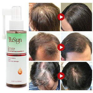 תרסיס נגד נשירת שיער פאנסון, פורמולה 2 ב-1 לצמיחת שיער, חידוש זקיקי השיער, בקרת שומן, נגד קשקשים, תמצית ג'ינג'ר - Product Image 1