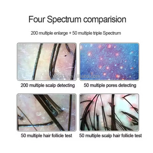 Analizzatore del Cuoio Capelluto di Grado Professionale da 15 Pollici, Scanner per Follicoli Capillari per Cliniche di Cura dei Capelli - Product Image 4