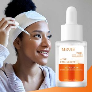 30ml Premium yüz serumu adanmış akne kaldırma ustalıkla formüle pürüzsüz yoğun cilt derinden tutarken gözenekleri rafine - Product Image 2