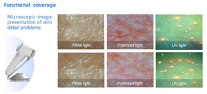 3D <b>Skin</b> Analyzer <b>Machine</b> for Multi-Dimensional <b>Skin</b> <b>Analysis</b> Wrinkle & Melanin Detection Dermatoscope Professional Face <b>Skin</b> - Product Image 6