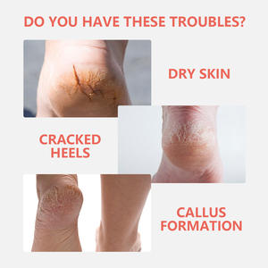 Crema para el Cuidado de los Pies con 10% de Urea para Reparar Talones Agrietados, Suavizar Callosidades e Hidratar Profundamente los Pies Secos - Product Image 2