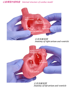 Simulateur <span class=keywords><strong>de</strong></span> formation en intervention coronaire percutée avec cœur battant pour <span class=keywords><strong>la</strong></span> formation aux procédures interventionnelles cardiovasculaires - Product Image 5
