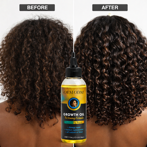 Tratamiento para la Caída del Cabello, Marca Privada OEM/ODM, Suero Natural Orgánico 2 en 1 para Engrosar el Cabello, Aceite para el Crecimiento, Hidratante y Revitalizante - Product Image 3