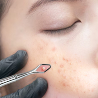 Juego de Herramientas para Eliminar Puntos Negros de Acero Inoxidable, Espátula Facial Ultrafina, Kit de Limpieza de Poros con Estuche de Cuero