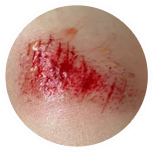 Pomada de Hialuronato de Sodio Bioactivo de Marca Privada OEM para la Eliminación de Cicatrices, Curación de <span class=keywords><strong>Heridas</strong></span> y Reparación de Estrías, 20g - Product Image 4