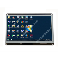 Module d'équipement médical 2026 haute définition avec écran tactile capacitif TFT LCD de 10,1 pouces, interface multimédia pour lecture vidéo