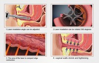 Appareil de resserrement vaginal à poignée unique pour traitement vaginal, idéal pour les salons de beauté