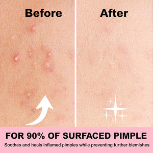 Parches Estrella Brillantes para Imperfecciones, Diseño Brillante para Fiestas, Eventos y Uso Diario Divertido - Product Image 2