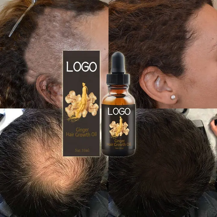 OEM, индивидуальное лечение волос, восстанавливающее и гладкое восстановление, выпадение волос, утолщенная Имбирная Сыворотка для роста волос для мужчин