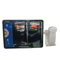 Ecógrafo Doppler Color Portátil Inalámbrico Veterinario 3 en 1 con USB y Wifi, Sonda Convexa y Lineal para Animales