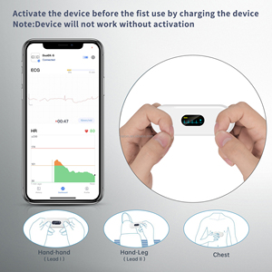 Viatom Duoek S Monitor de Freqüência Cardíaca Ecg bateria recarregável Bluetooth Handheld Ecg Ekg Monitor Portabilidade Holter Monitor Ecg - Product Image 2