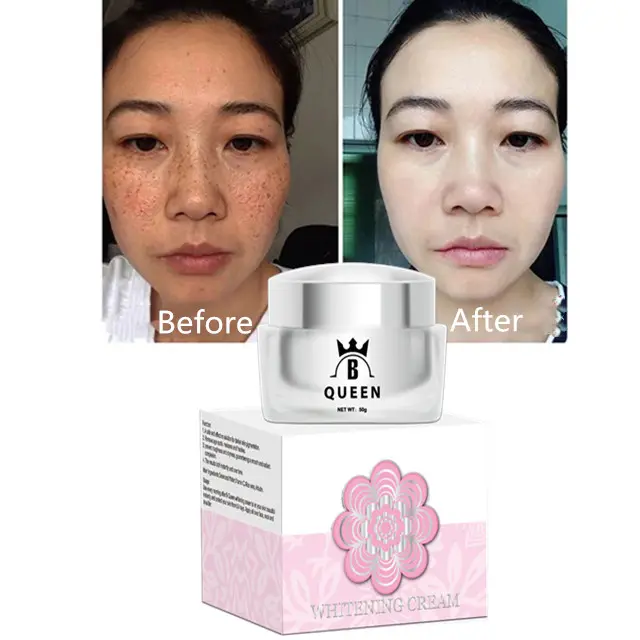 Chinese Clear Beauty Collagen Best Skin Whitening Face Lift Cream For Black Skin Women