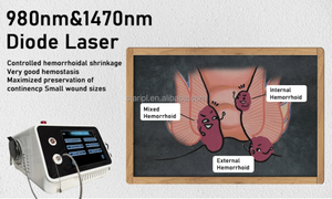 Removedor de pilas Cirugía Hemorroides Sonda láser 1470nm 980nm Fístula Anal Hemorroidoplastia Urología Proctología Máquina médica - Product Image 2