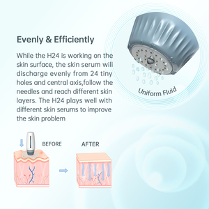 Rodillo Dérmico Ajustable H24 con Cámara de Suero 0-1.5mm para Infusión de Esencia en el Cuidado Facial, Uso Doméstico y Profesional, en Envase Aséptico - Product Image 3