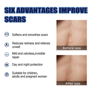 Crema Reparadora de Cicatrices EELHOE, Aclara Cicatrices de <span class=keywords><strong>Embarazo</strong></span> y Cirugí<span class=keywords><strong>a</strong></span>, Suaviza la Piel, Crema para el Cuidado de la Piel, 50 ml - Product Image 5