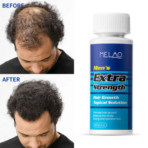 Sérum de croissance capillaire naturel à base de plantes, renforcement de la biotechnologie, feuille de biota orientalis, niacinamide, kératine, activation des racines des cheveux, croissance des cheveux pour femmes - Product Image 6