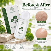Lotion Visage Fermentée à la Centella Asiatica Apaisante Hydratante Soin Anti-rougeurs Renforce la Barrière Cutanée Peaux Sensibles