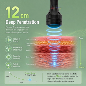 Máquina de Terapia de Ondas de Choque Profesional Deepwave Pro, Dispositivo de Tratamiento de Ondas de Choque Enfocadas para la Disfunción Eréctil y el Manejo del Dolor - Product Image 4