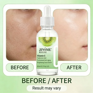 Sérum Visage Anti-âge Éclaircissant Anti-taches à la Vitamine C et au Kiwi Or, Marque Privée, Antioxydant – Offre Spéciale - Product Image 5