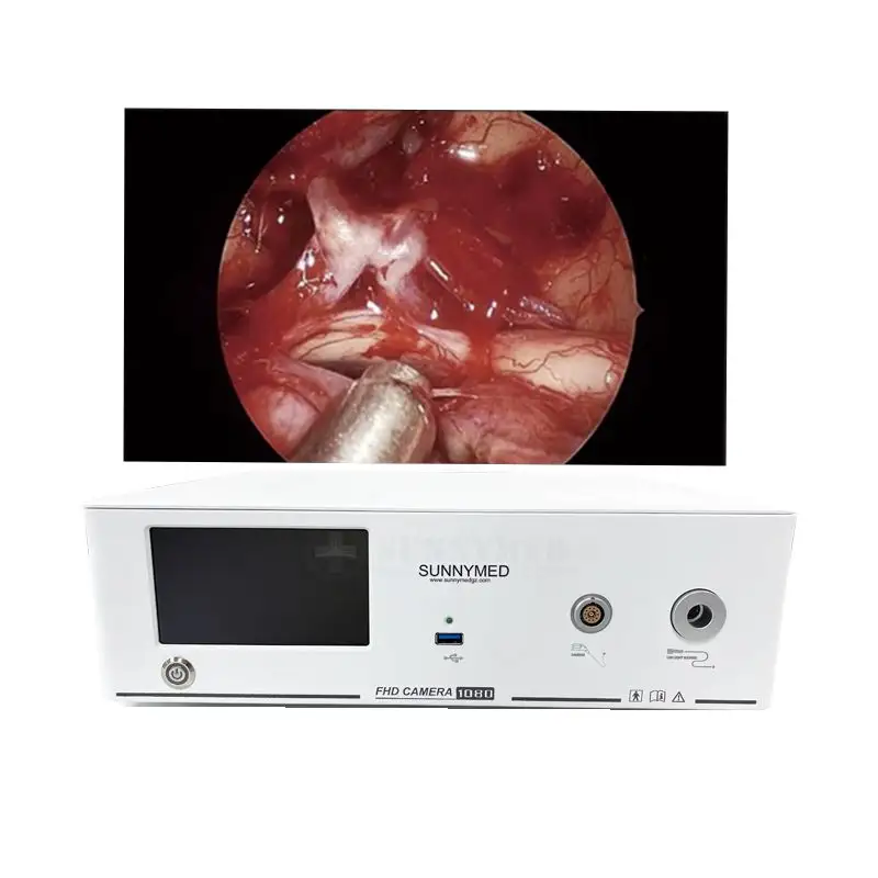 PS048T Système d'imagerie pour chirurgie médicale hystéroscope portable endoscopie système de caméra endoscopique à led guide de lumière système endoscopique