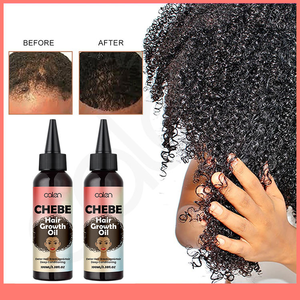 น้ำมันใส่ผมเชเบ้ แบรนด์ส่วนตัว 100 มล. น้ำมันบำรุงเส้นผมสำหรับใช้ทุกวัน ลดการหลุดร่วงของเส้น<span class=keywords><strong>ผม</strong></span> เสริมความแข็งแรงให้เส้นผม - Product Image 2