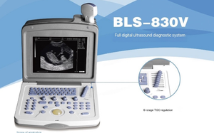 Draagbare Mini-Draagbare Veterinaire Ultrasone Scanner Diergeneeskundig Therapeutische Apparatuur - Product Image 2
