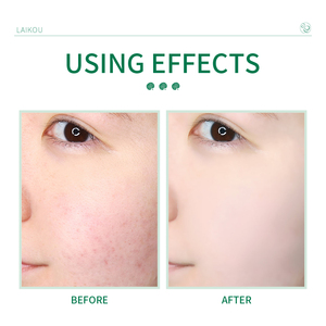 LAIKOU <span class=keywords><strong>OBM</strong></span> Private Label detergente viso idratante Niacinamide Centella olio di controllo della pelle cura del viso lavaggio detergente per le donne - Product Image 6
