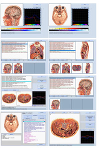 Analizador de Salud Corporal 9D Meta-Therapy VegetoTest Reprinter, Todo en Uno, para Comprobar la Propensión a Enfermedades y el Bienestar - Product Image 3