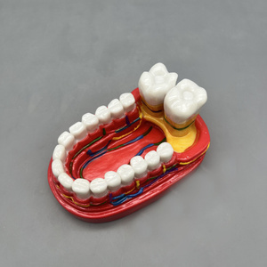 โมเดลฟันสำหรับการสื่อสารทางการแพทย์การแสดงผลในช่องปาก - Product Image 4