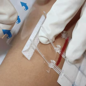 ไหมเย็บแผลไฮโดรคอลลอยด์แบบซิป  ไหมเย็บแผลไฮโดรคอลลอยด์แบบซิปล็อค - Product Image 5