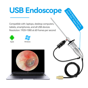 Endoscopio Veterinario USB 1080P con Cámara de Endoscopia de Luz Fría, Aumento de 6x y Función de Congelación de Imagen para Inspección Animal - Product Image 1