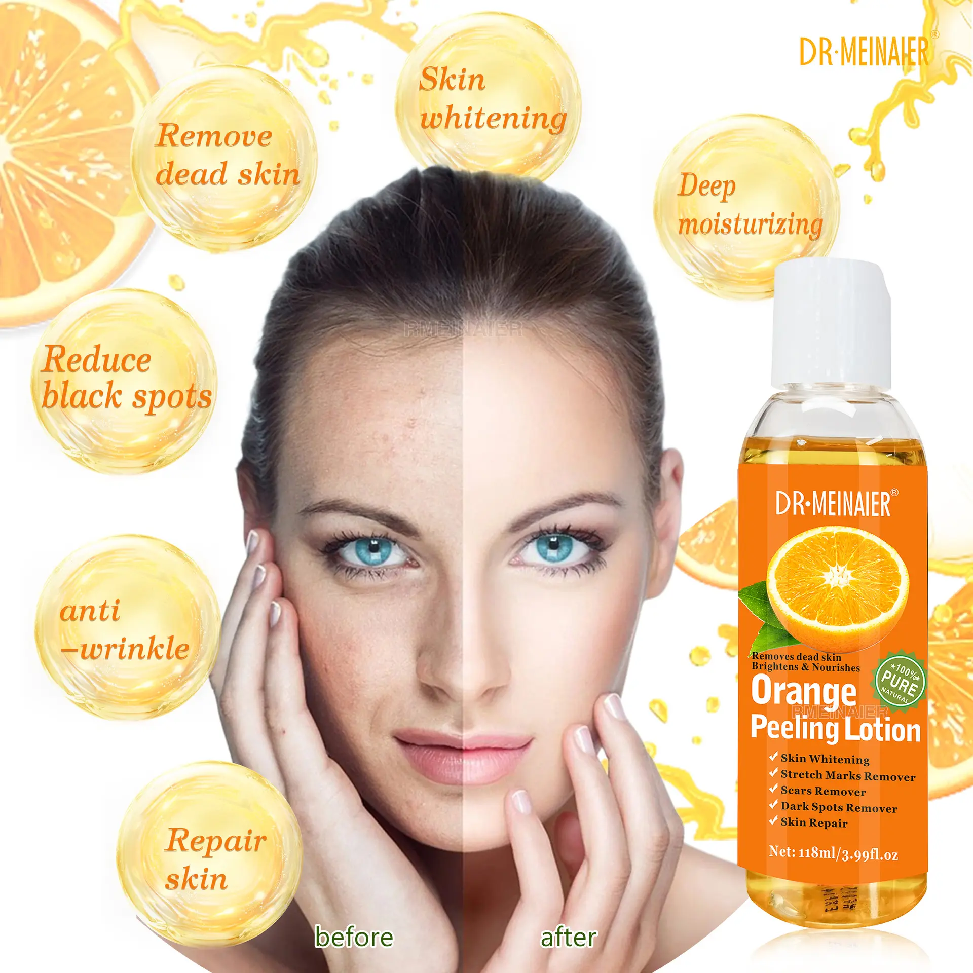 Lozione arancione naturale naturale forte Peeling olio sbiancante pelle che illumina la smagliatura rimozione forza Peeling olio pelle scura