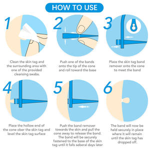 ELAIMEI 2 in 1 Micro <strong>Skin</strong> <strong>Tag</strong> Remover Kit Beauty Tools Mole and Wart <strong>Removal</strong> Pen for Small to Large <strong>Skin</strong> <strong>Tag</strong> 1-9mm - Product Image 6