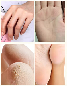 Crema Invernale per Mani e Piedi <span class=keywords><strong>con</strong></span> Olio di Cavallo, Vitamina C, Urea e Acido Ialuronico per Riparazione Rapida del Tallone Secco e Miglioramento della Texture della <span class=keywords><strong>Pelle</strong></span> - Product Image 6