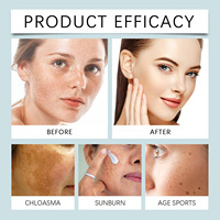 Crème Correctrice Anti-Taches OEM/ODM 50g – Hydratant Éclaircissant et Blanchissant pour le Visage – Élimination de la Mélanine – Soin de la Peau du Visage