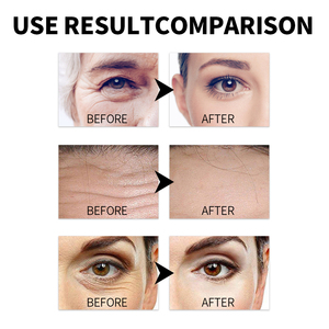Crème Visage Exclusive Transfrontalière pour <span class=keywords><strong>le</strong></span> Commerce International à la Bave d'<span class=keywords><strong>Escargot</strong></span> Hydratante, Raffermissante et Resserre les Pores - Product Image 4