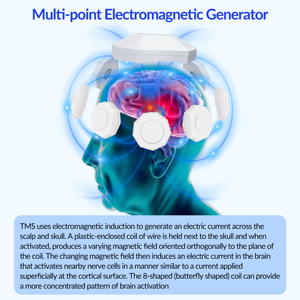 Dispositivo de Biofeedback de Estimulación Transcraneal (TMS) para Terapia de Accidentes Cerebrovasculares, Parkinson, <span class=keywords><strong>Esquizofrenia</strong></span>, Autismo, Trauma por Estres Post-Traumático (TPT) y Epilepsia - Product Image 2